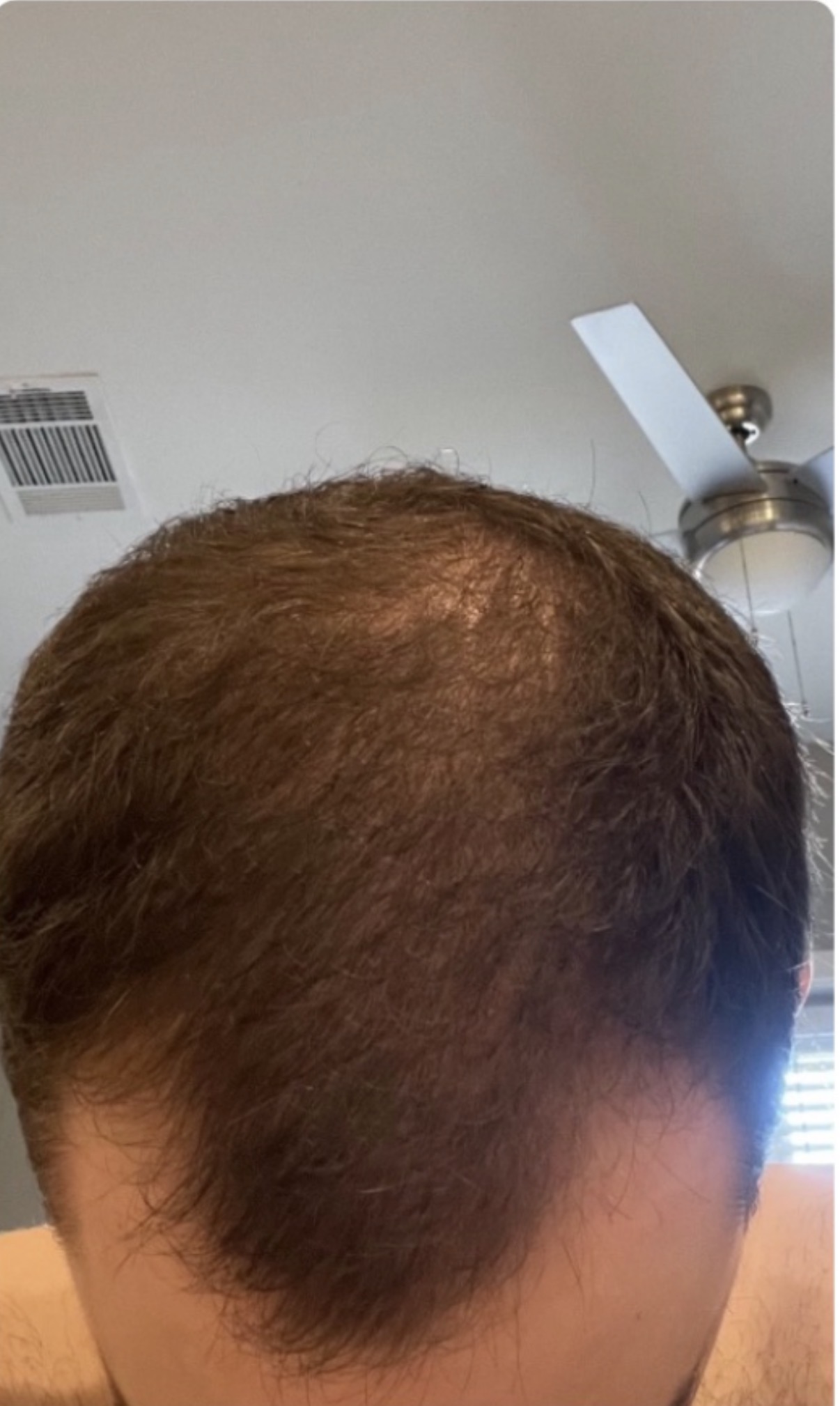 Current — significant regrowth